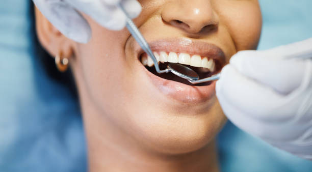 Best Dentist for Tooth Abscess  in Trevorton, PA