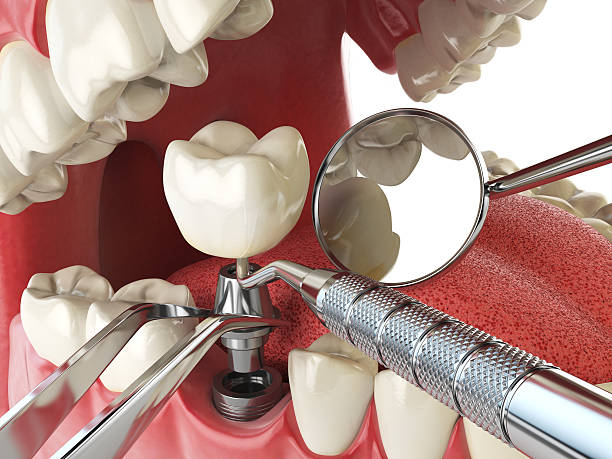 Best Cracked Tooth Emergency Dentist  in Trevorton, PA